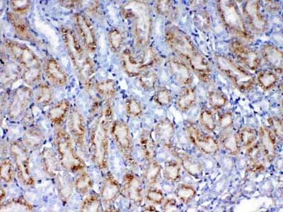 2 - Anti-Galectin 1 Picoband Antibody ABO12847