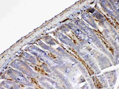 2 - Anti-Galectin 1 Picoband Antibody ABO12847