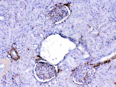 2 - Anti-Galectin 1 Picoband Antibody ABO12847