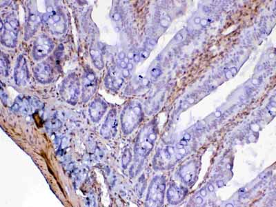 2 - Anti-Galectin 1 Picoband Antibody ABO12847