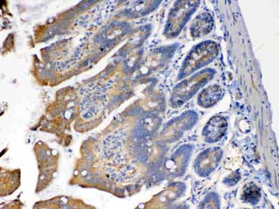 2 - Anti-PON1 Picoband Antibody ABO12853