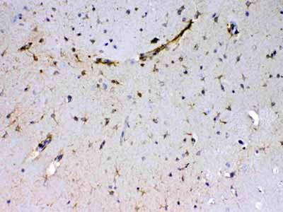 2 - Anti-Sacsin Picoband Antibody ABO12855