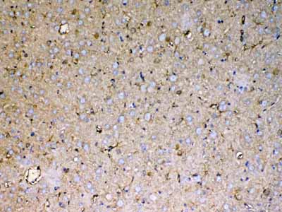 2 - Anti-Sacsin Picoband Antibody ABO12855