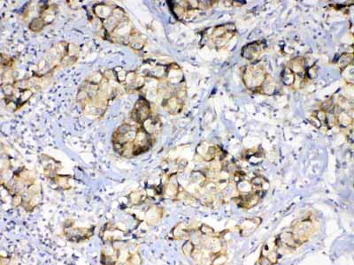 2 - Anti-GALE Picoband Antibody ABO12857