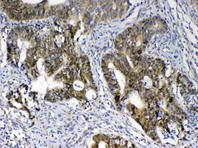 2 - Anti-GALE Picoband Antibody ABO12857