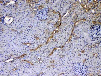 2 - Anti-GALE Picoband Antibody ABO12857