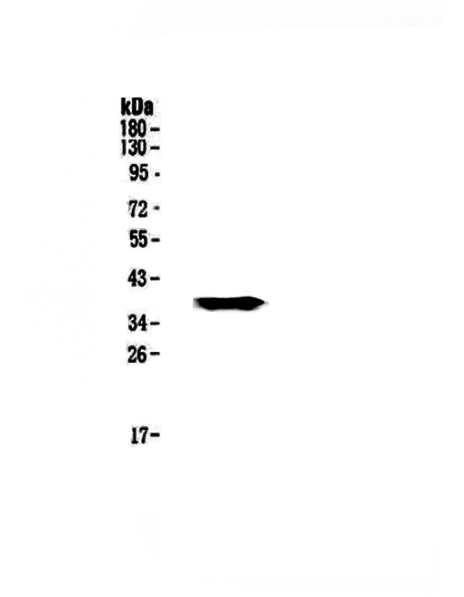 1 - Anti-GALE Picoband Antibody ABO12857