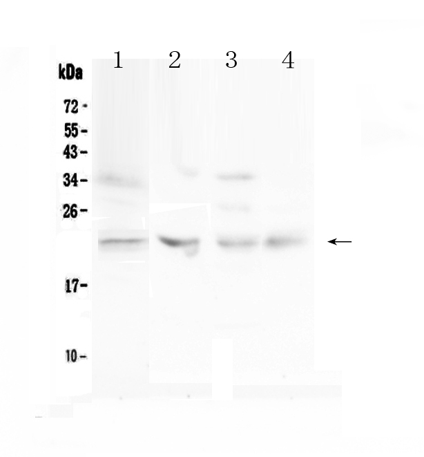1 - Anti-TIMP1 Picoband Antibody ABO12858