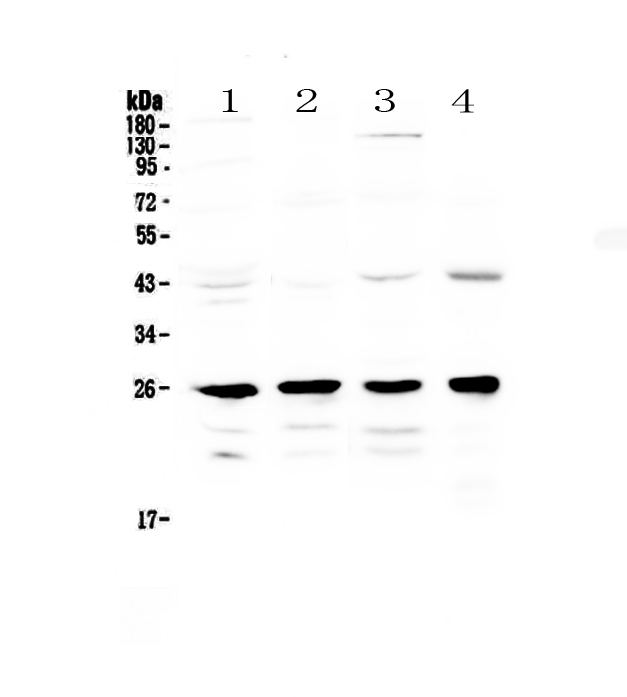 1 - Anti-GSTM1 Picoband Antibody ABO12860