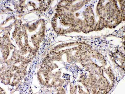 2 - Anti-XRCC1 Picoband Antibody ABO12861