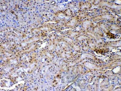 2 - Anti-XRCC1 Picoband Antibody ABO12861