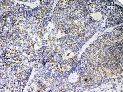 2 - Anti-PTPN22 Picoband Antibody ABO12862