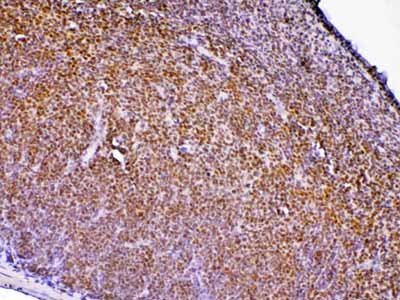 2 - Anti-PTPN22 Picoband Antibody ABO12862