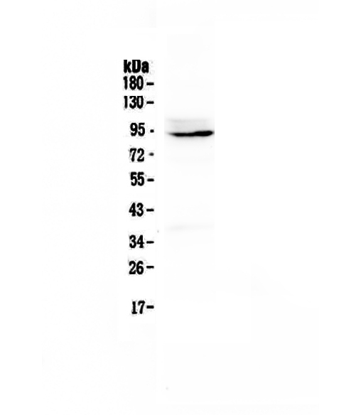 1 - Anti-PTPN22 Picoband Antibody ABO12862