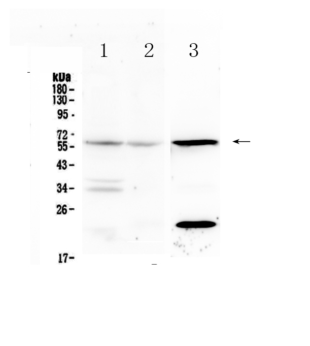 1 - Anti-IL23 Receptor Picoband Antibody ABO12865