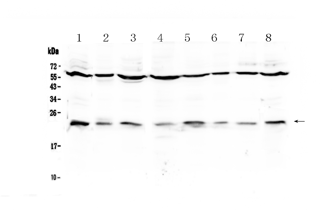 1 - Anti-IL1RA Picoband Antibody ABO12870
