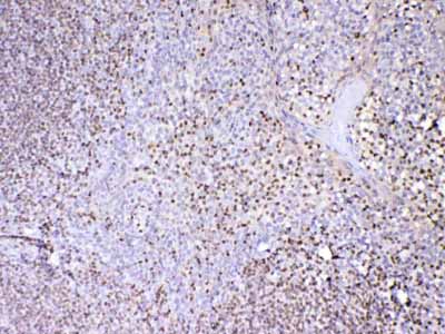 2 - Anti-PAX5 Picoband Antibody ABO12875