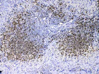 2 - Anti-PAX5 Picoband Antibody ABO12875