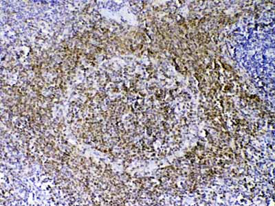 2 - Anti-PAX5 Picoband Antibody ABO12875