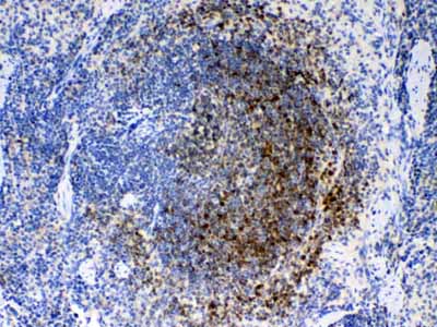 2 - Anti-Bid Picoband Antibody ABO12876