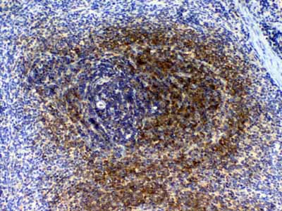 2 - Anti-Bid Picoband Antibody ABO12876