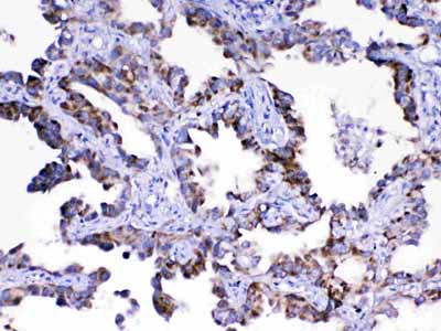 2 - Anti-Adenylosuccinate Lyase Picoband Antibody ABO12877