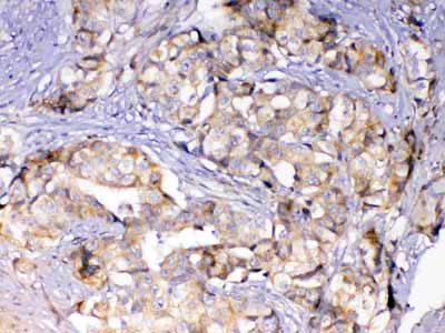 2 - Anti-Adenylosuccinate Lyase Picoband Antibody ABO12877