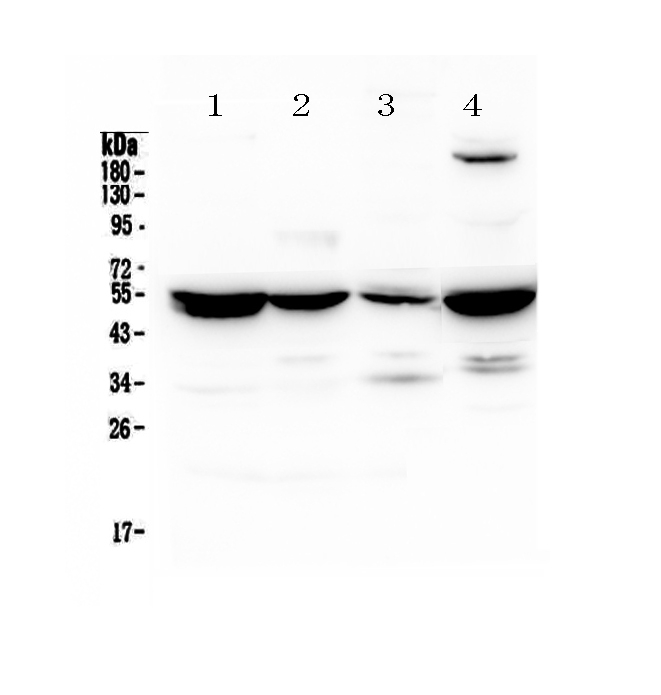 1 - Anti-Adenylosuccinate Lyase Picoband Antibody ABO12877