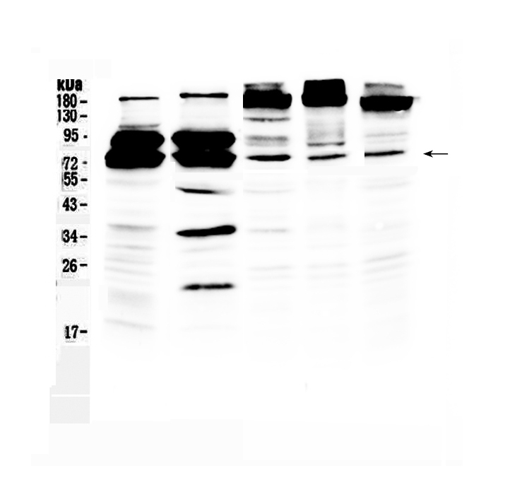 1 - Anti-DDX3 Picoband Antibody ABO12879