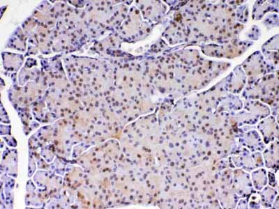 2 - Anti-PARK7 / DJ1 Picoband Antibody ABO12880