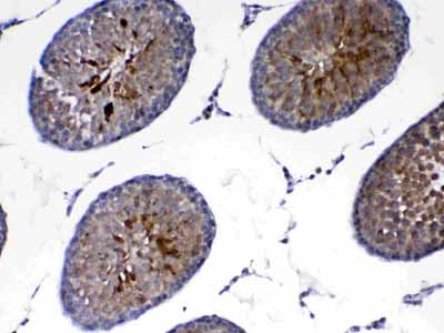 2 - Anti-PARK7 / DJ1 Picoband Antibody ABO12880