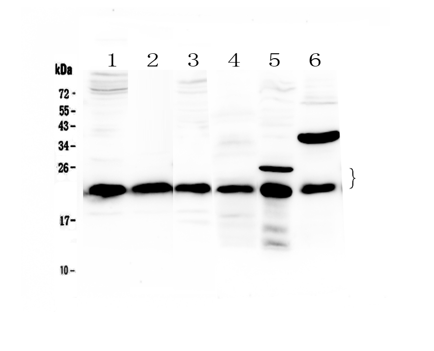 1 - Anti-PARK7 / DJ1 Picoband Antibody ABO12880