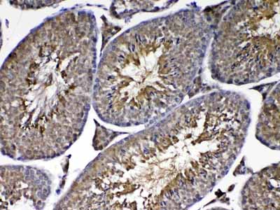 2 - Anti-PARK7 / DJ1 Picoband Antibody ABO12881