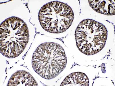 2 - Anti-PARK7 / DJ1 Picoband Antibody ABO12881
