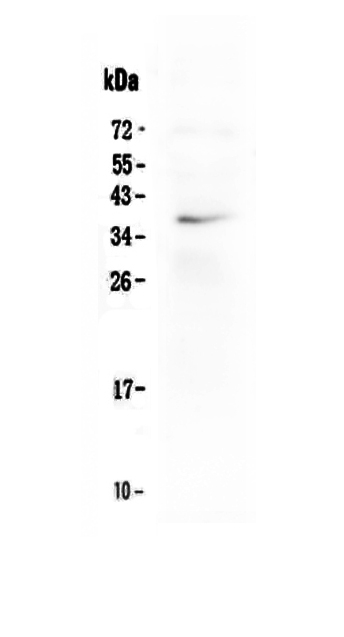 1 - Anti-LOX-1/OLR1 Picoband Antibody ABO12882