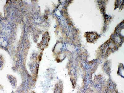 2 - Anti-PAH Picoband Antibody ABO12883