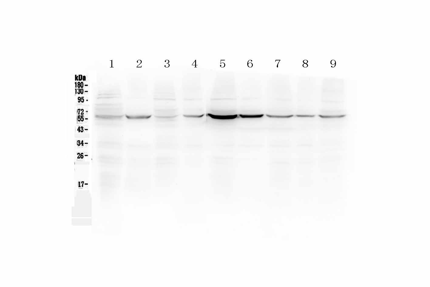 1 - Anti-ESR2 Picoband Antibody ABO12885