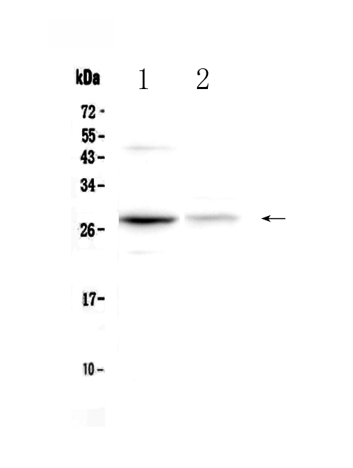 1 - Anti-Oncostatin M Picoband Antibody ABO12886