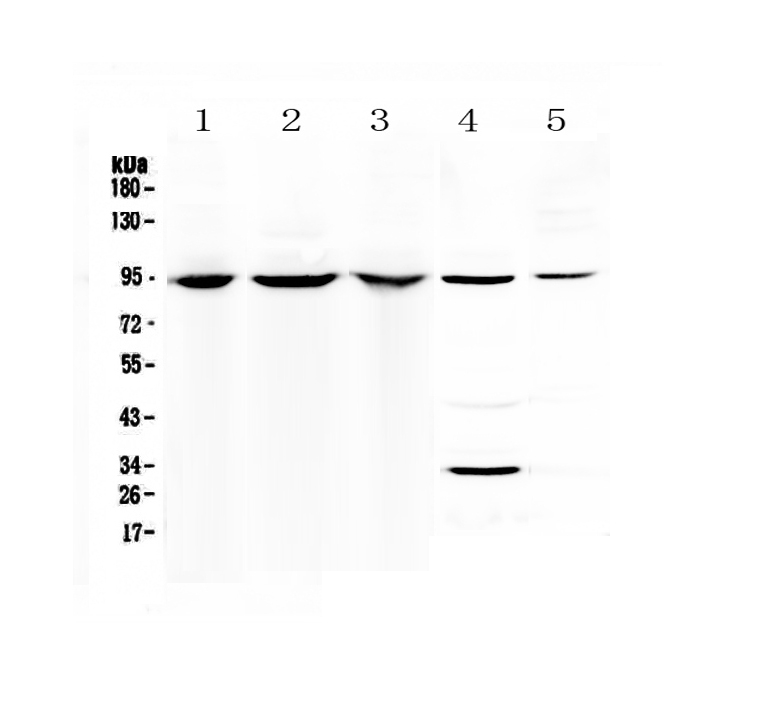 1 - Anti-Complement C7 Picoband Antibody ABO12891