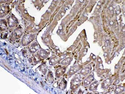 2 - Anti-ADA Picoband Antibody ABO12892