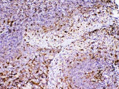 2 - Anti-ADA Picoband Antibody ABO12892
