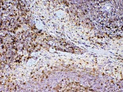 2 - Anti-ADA Picoband Antibody ABO12892