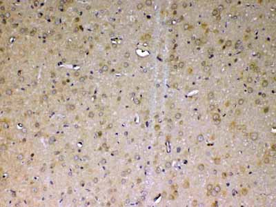 2 - Anti-ADA Picoband Antibody ABO12892