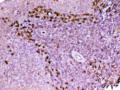 2 - Anti-ADA Picoband Antibody ABO12892