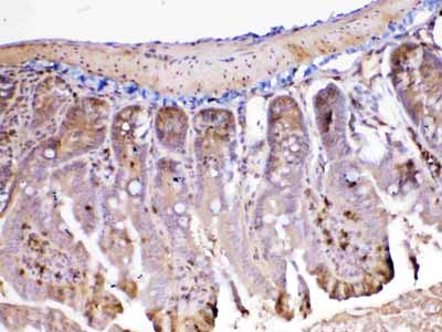 2 - Anti-ADA Picoband Antibody ABO12893