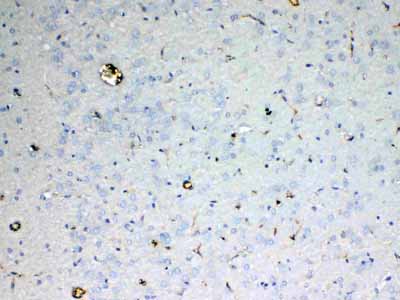 2 - Anti-ADA Picoband Antibody ABO12893