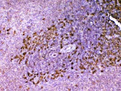 2 - Anti-ADA Picoband Antibody ABO12893