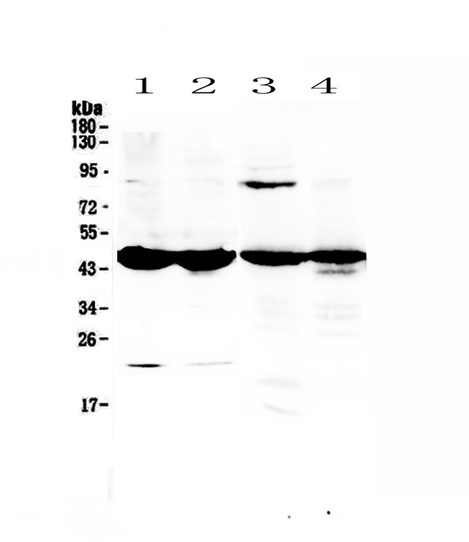 1 - Anti-ADA Picoband Antibody ABO12893