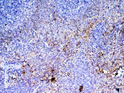2 - Anti-PF4 Picoband Antibody ABO12894