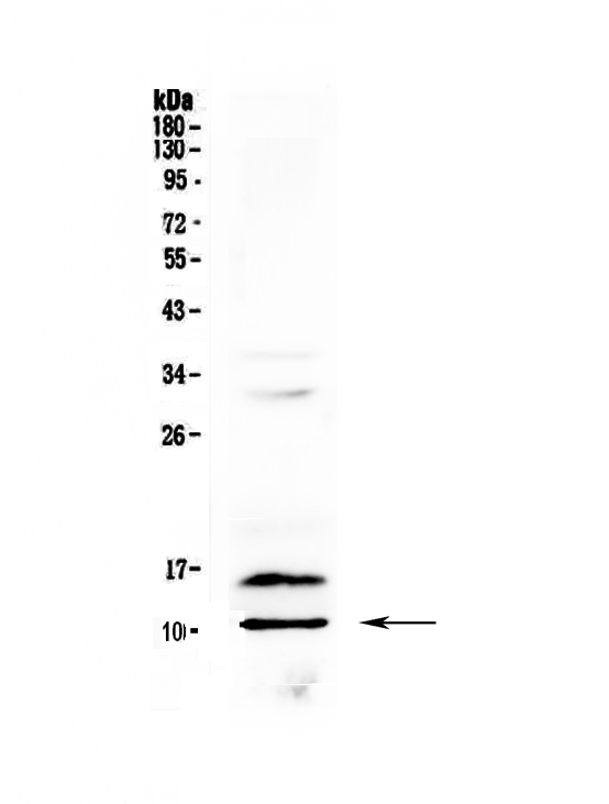 1 - Anti-PF4 Picoband Antibody ABO12894